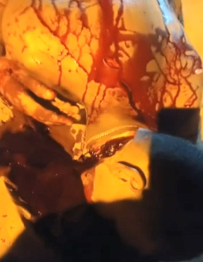 Man Discovers A Mutilated Corpse