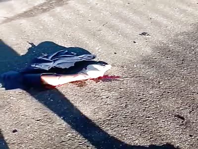 Hey I Think You Left Your Leg Over Here