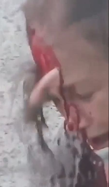 Muslims Rip An Elderly White Womans Face Off