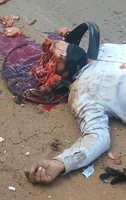 Head Cracked Open Like An Egg