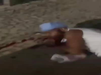 Shot Twice And Pistol Whipped