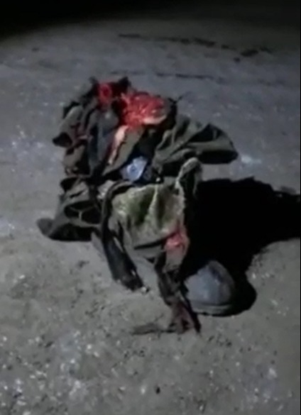 Russian Soldier Forget His Leg When He Was Retreating