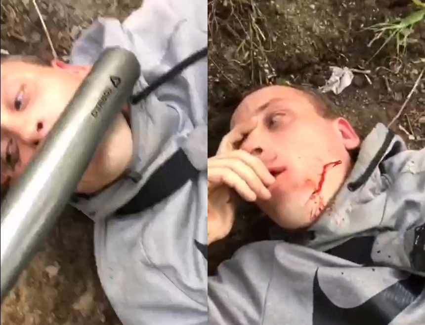 Man Gets His Face Smashed With An Iron Bar