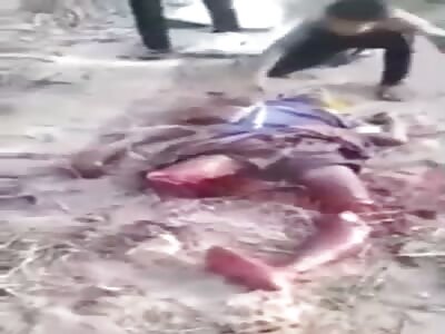 Man Gets Dismembered By Machete