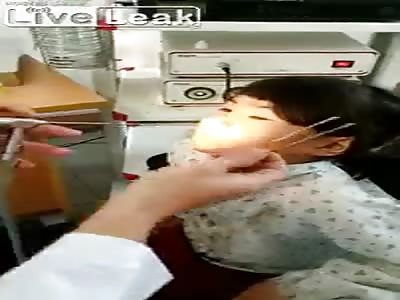 Strange worms retrieved from little girl's nose...