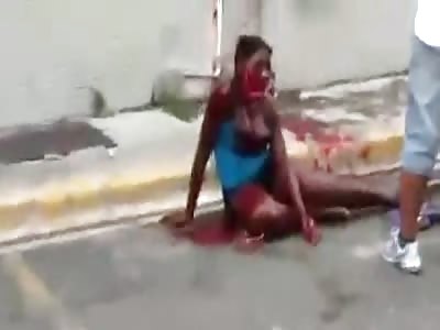 Difigured Woman Begs For Help 