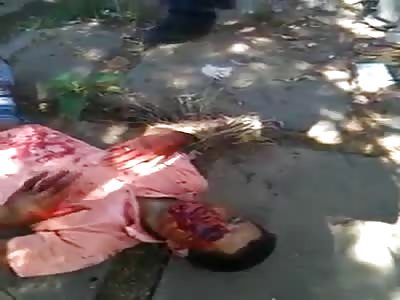 Young man shot in the eye and two in the back waiting ambulance