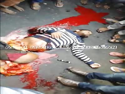 Horrible Accident: Man Cut in Half Still Alive (New Angle and Better quality)