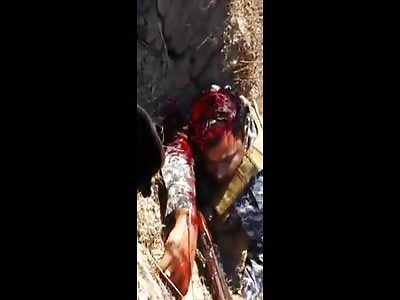  The Battle of Tikrit: The last moments of a dying iraqi federal policeman hit by an isis-sniper.