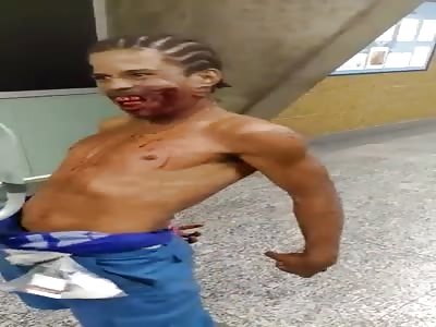 Man arrived at Miguel Couto Hospital in Rio de Janeiro with a bullet in his mouth and was possessed by Satan