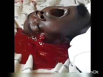 Gang Member Shot in Head in San Fernando, Trinida