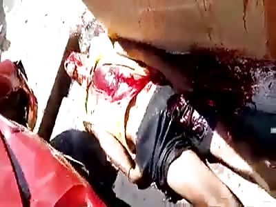 Accident with Car several people pressed in the Hardware