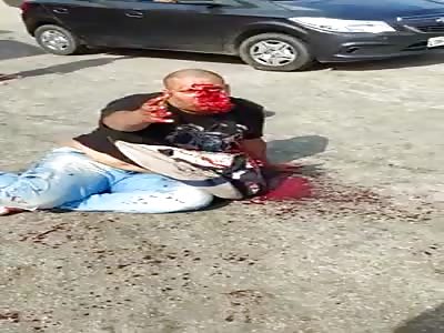 Man's face was destroyed after crashing in front of car