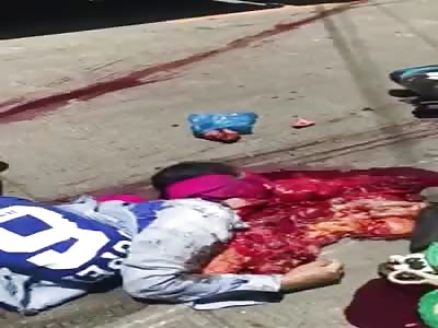 Man crushed in an accident