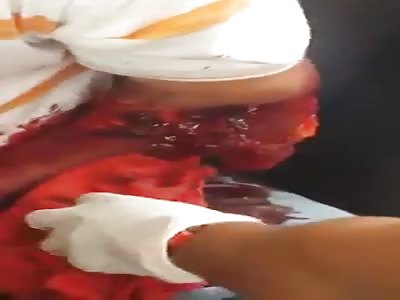 Man injuried atack machete