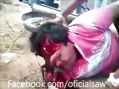 Man with face disfigured accident biker