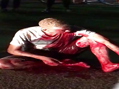 Man blooding after several shots 