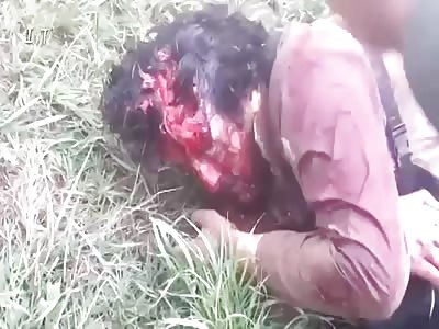 Soldier after taking a headshot