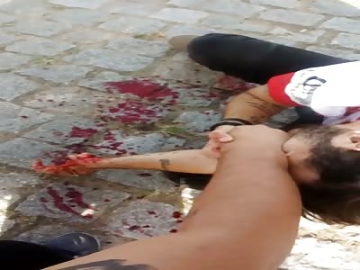 Man crash with his fucked hand