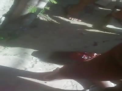 Woman gets seriously injured in a fight with piece of wood in a favela in Brazil