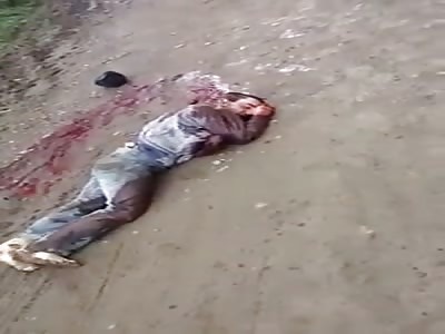 Atack with machete man cut arm