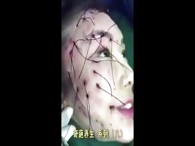 Crazy oriental medicine