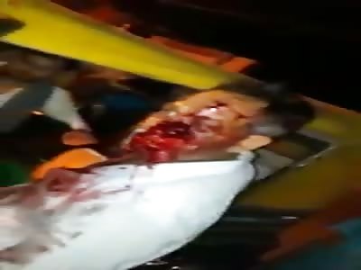 Shock: Man with Face Destroyed Walking Around