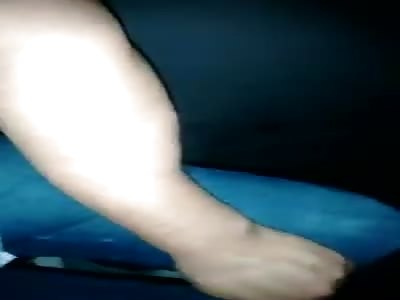 Man breaks a woman's arm