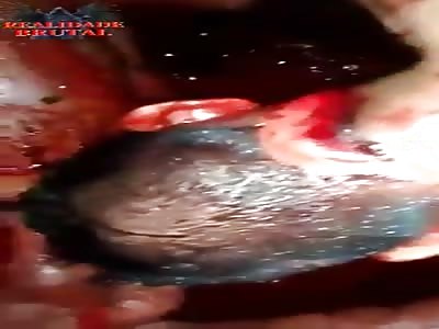 Man injured with machete blows