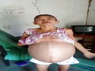 Woman with HORRIFIC cÃ¢ncer 