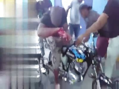 Man has his arm cut in a knife fight