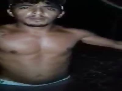 thief get shot by shotgun on the hand