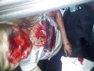 Accident with Boy head crash Truck