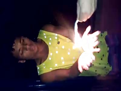 Thief punished with molten plastic in the hands LOL happened in my city