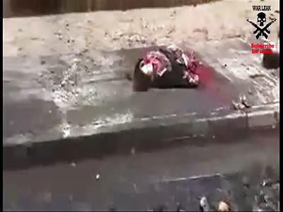 Victims Of Mortar Shelling In Iraque I