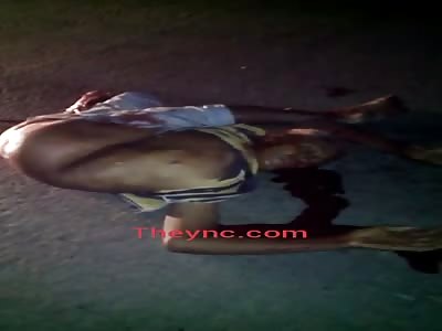 Cool man in spite of  suffer Accident expressed your interest with a New posture twister