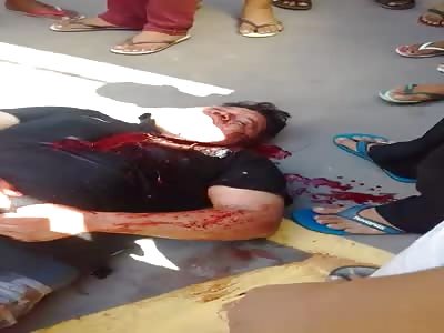 Agonizing after several headshot 