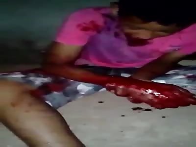 boy took shots in the hands