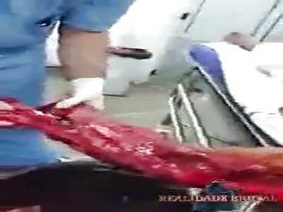 ohh my arm destroyed