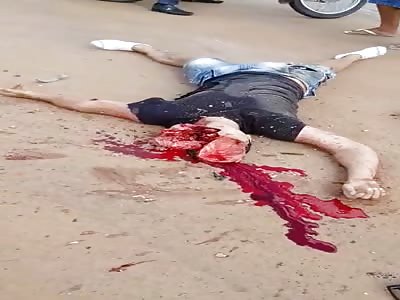 (Long video 1:34  minute ) accident with biker