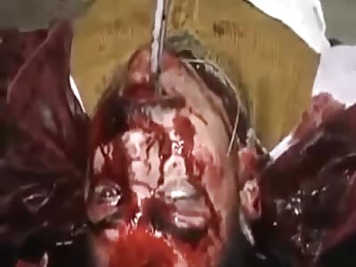 horrible war scenario in Syria