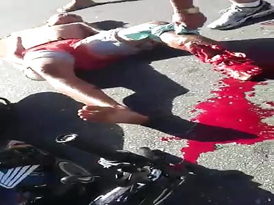 Man Leg Ripped to Shreds after Terrible Accident