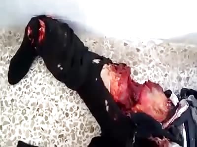 Old Man Killed By Syrian Army Artillery Attack) 