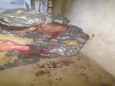 Agonizing after shot on the neck 