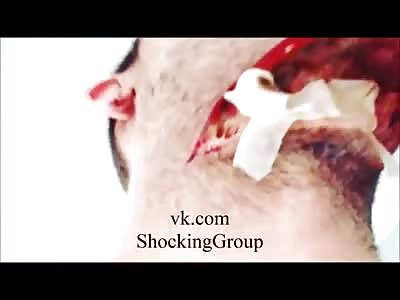 WTF man with cut neck does self...