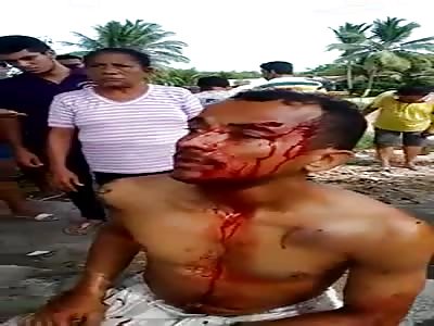 Injuried after get several shot