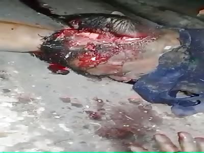  Brutal murder man with head destroyed after shotgun shot  