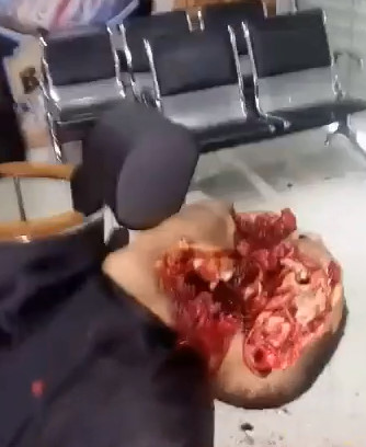 Ready for the Disguises Party After SHOTGUN SHOT