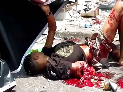 Fireworks vendor suffers accident