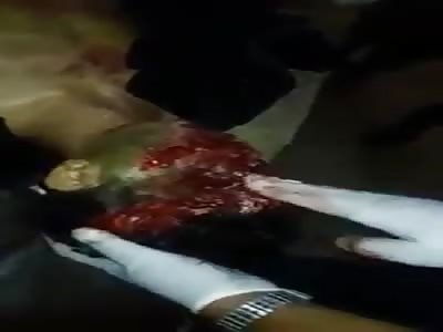 Face Destroyed After Being Shot